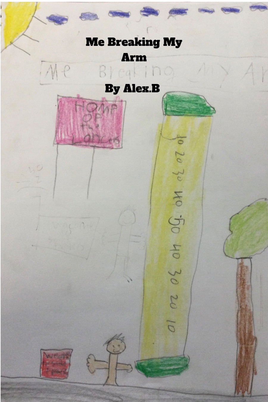 Me Breaking My Arm by Alex B