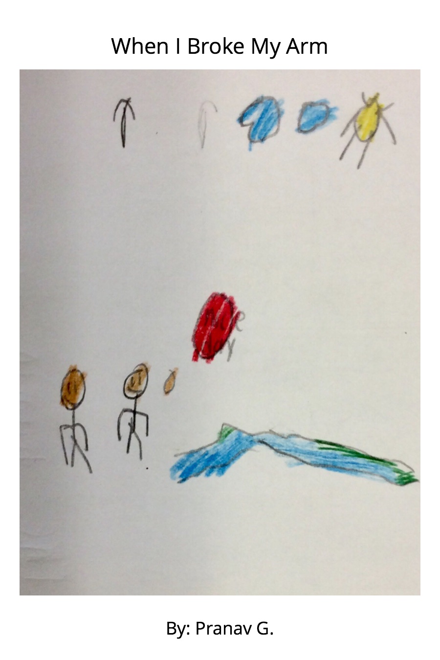 When I Broke My Arm by Pranav G